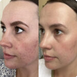 Why Patients Choose Eternia Medspa