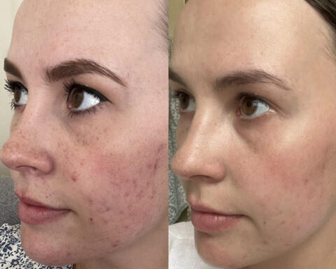 Why Patients Choose Eternia Medspa